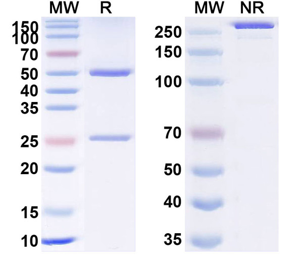 Anti-Human CD28 Recombinant Monoclonal Antibody (TGN1412) - SDS-PAGE