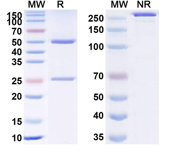 Anti-Human CD28 Recombinant Monoclonal Antibody (TGN1412) - SDS-PAGE