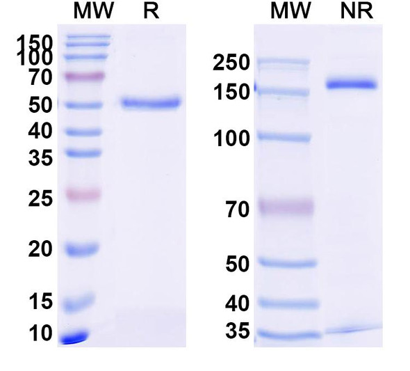 Anti-Human TNFa/TNF-alpha Recombinant Monoclonal Antibody (SAA2236) - SDS-PAGE