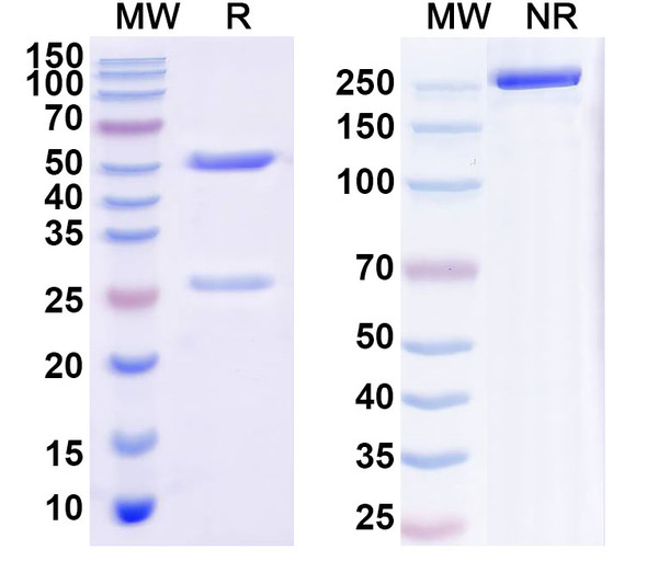 Anti-Human RSPO2 Recombinant Recombinant Monoclonal Antibody (h130M23-H1L6) - SDS-PAGE