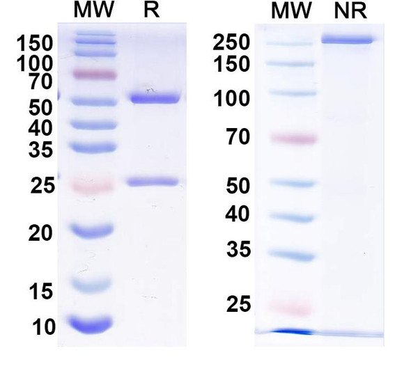 Anti-Human CXCL3 Recombinant Monoclonal Antibody (SAA2246) - SDS-PAGE