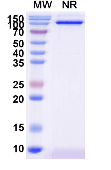 Anti-Human DKK1 Recombinant Monoclonal Antibody (SAA1268) - SDS-PAGE