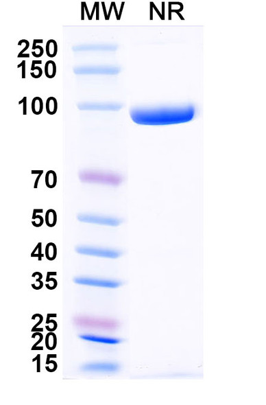 Anti-Human CD3E Recombinant Nanobody (SAA2242) - SDS-PAGE