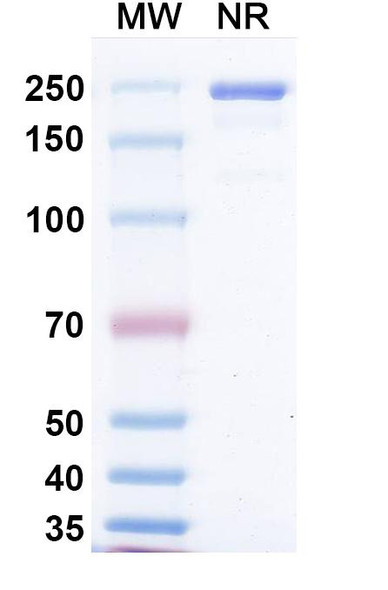 Anti-Measles virus/MeV F/Fusion Recombinant Monoclonal Antibody (mAb 77) - SDS-PAGE