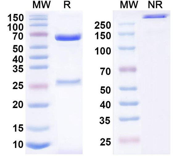 Anti-Measles virus/MeV F/Fusion Recombinant Monoclonal Antibody (mAb 77) - SDS-PAGE