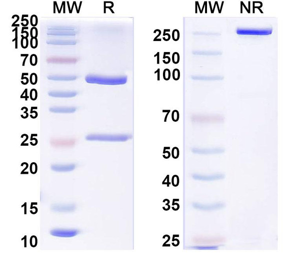 Anti-TBEV Envelope protein E Recombinant Monoclonal Antibody (19/1786) - SDS-PAGE