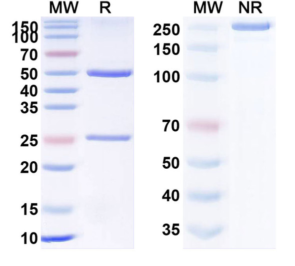 Anti-SFTSV glycoprotein Gn Recombinant Monoclonal Antibody (JK-12) - SDS-PAGE