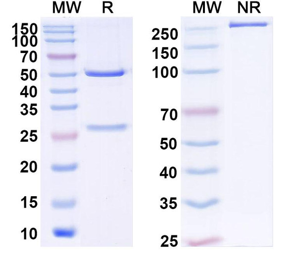 Anti-Human ARRB1 Recombinant Monoclonal Antibody (SAA2250) - SDS-PAGE