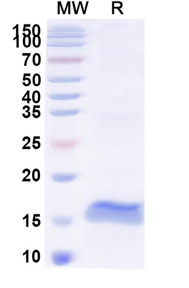 Anti-Pig Pancreatic alpha-amylase/AMY2 Recombinant Nanobody (SAA2257) - SDS-PAGE