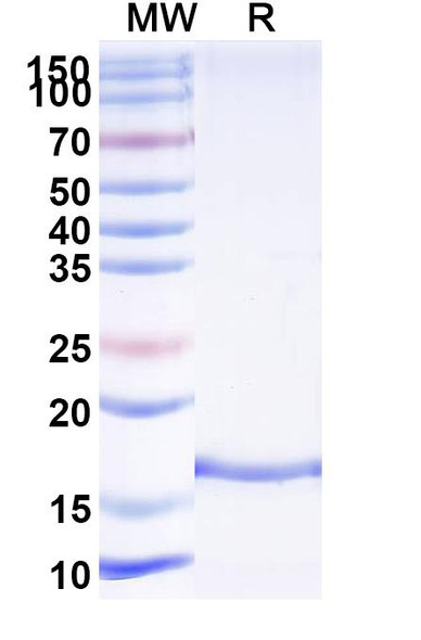 Anti-HPIV-3 Fusion glycoprotein F0 Recombinant Nanobody (SAA2258) - SDS-PAGE
