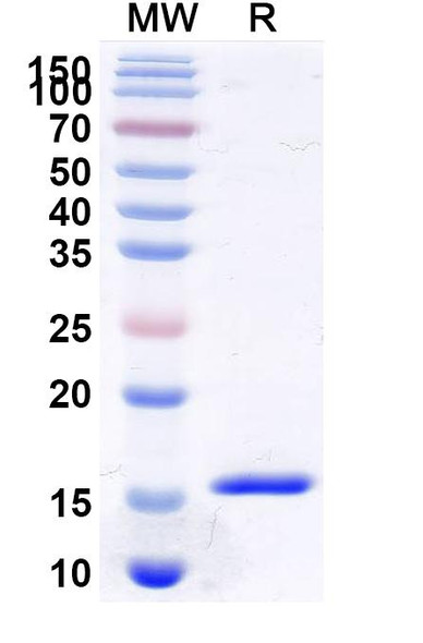 Anti-Human CDKN2A/p16INK4a Recombinant Nanobody (SAA2259) - SDS-PAGE