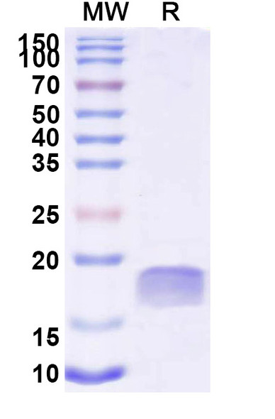 Anti-Pseudomonas aeruginosa xcpQ Recombinant Nanobody (SAA2260) - SDS-PAGE