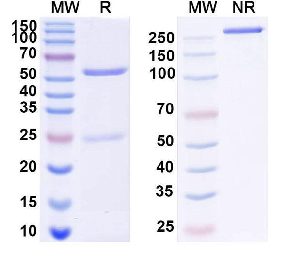 Anti-Theileria parva p67 Neutralizing Recombinant Monoclonal Antibody (SAA2263) - SDS-PAGE