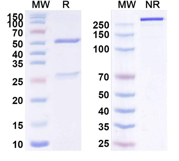 Anti-Mojiang virus/MojV F/Fusion Protein Recombinant Monoclonal Antibody (4G5) - SDS-PAGE