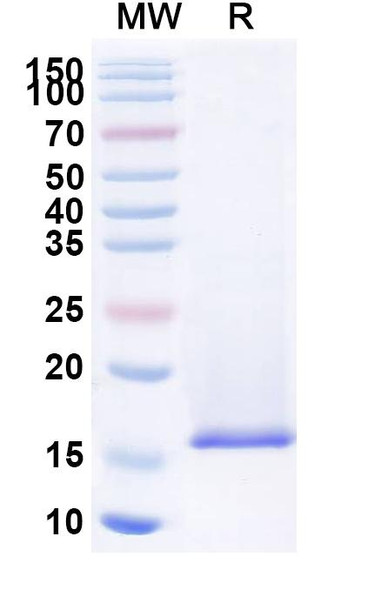 Anti-JUNV Nucleoprotein Recombinant Nanobody (SAA2268) - SDS-PAGE