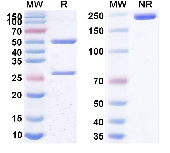 Anti-Helicobacter pylori babA Recombinant Monoclonal Antibody (SAA2271) - SDS-PAGE