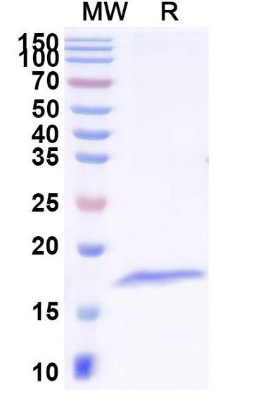 Anti-Common timothy PHLPIV/Phl p 4 Recombinant Nanobody (SAA2272) - SDS-PAGE
