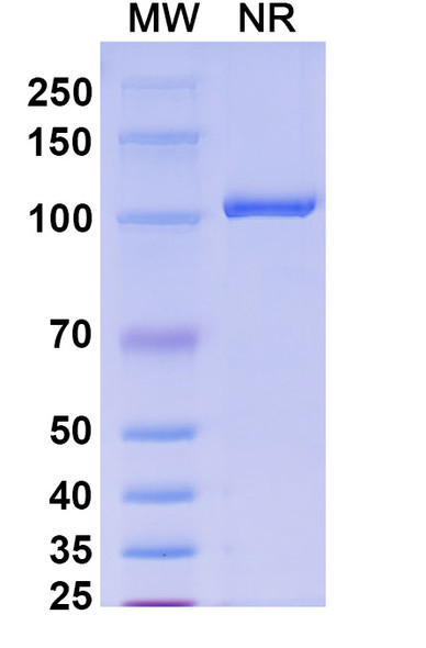 Anti-HPV16 E6/Protein E6 Recombinant Monoclonal Antibody (SAA2276) - SDS-PAGE