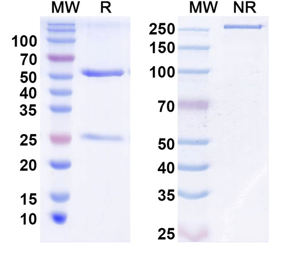Anti-Human EPHA2 Recombinant Monoclonal Antibody (SAA2278) - SDS-PAGE