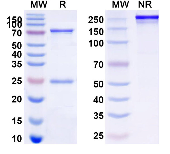 Anti-Human EPHA2 Recombinant Monoclonal Antibody (SAA2279) - SDS-PAGE