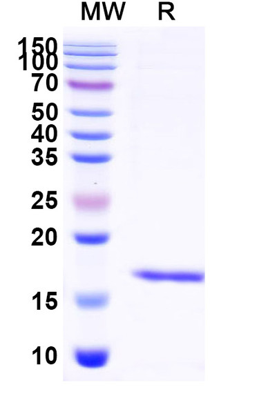 Anti-Human IL23R Recombinant Nanobody (SAA2282) - SDS-PAGE