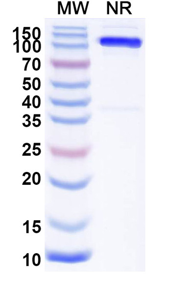 Anti-Mouse Mu-type opioid receptor/OPRM1/μOR Recombinant Nanobody (SAA2285) - SDS-PAGE