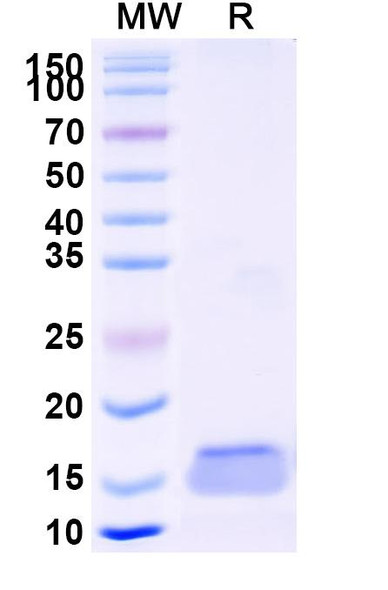 Anti-Human PTK7/CCK-4 Recombinant Nanobody (SAA2288) - SDS-PAGE