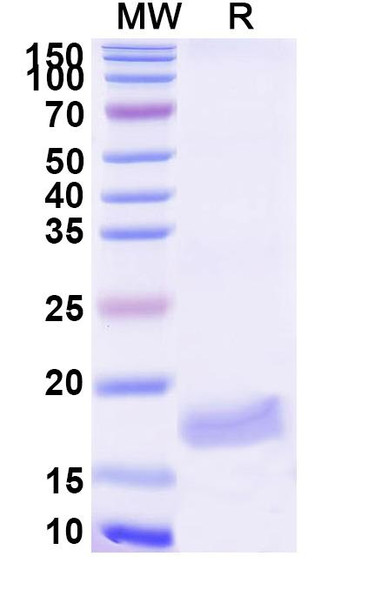 Anti-Zika Virus Envelope protein E Recombinant Nanobody (SAA2297) - SDS-PAGE