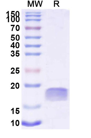 Anti-Human TTYH2 Recombinant Nanobody (SAA2300) - SDS-PAGE