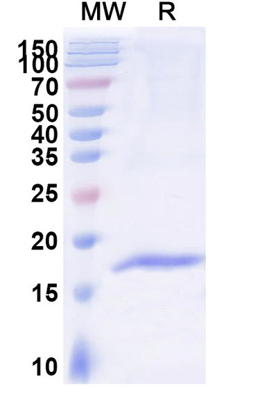 Anti-Human ACKR1/CD234 Recombinant Nanobody (SAA2301) - SDS-PAGE