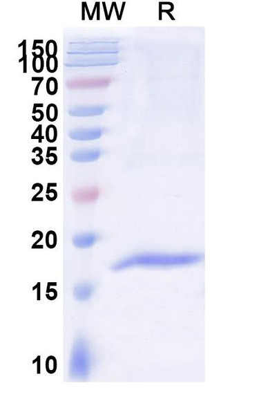 Anti-Human ACKR1/CD234 Recombinant Nanobody (SAA2301) - SDS-PAGE