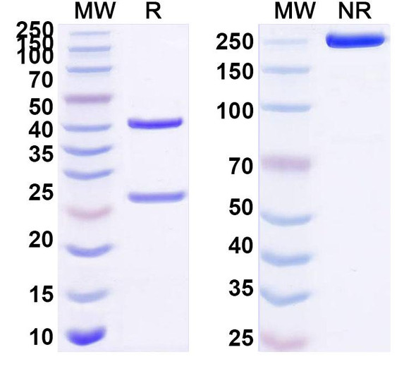 Anti-Human GRIN1/NMDAR1 Recombinant Monoclonal Antibody (#003-102) - SDS-PAGE