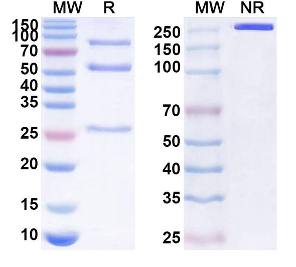 Anti-RABV G/Glycoprotein Recombinant Monoclonal Antibody (SO57) - SDS-PAGE