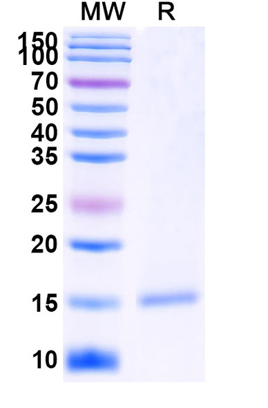 Anti-Human FOLH1/PSMA Recombinant Nanobody (SAA2305) - SDS-PAGE