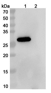 Anti-Human SLC34A2/NaPi2b Recombinant Monoclonal Antibody (SAA2315) - WB
