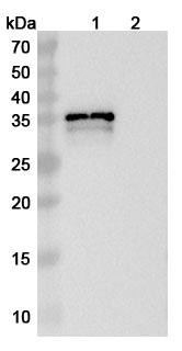 Anti-MPXV B6R/SL-159 Recombinant Monoclonal Antibody (hMB668) - WB