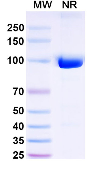 Anti-Nav1.4/Nav1.5 Na+ channel Recombinant Monoclonal Antibody (SAA2316) - SDS-PAGE