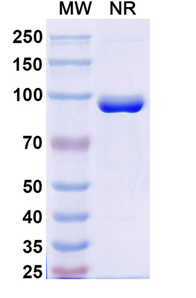 Anti-Human FZD3/Frizzled-3 Recombinant Nanobody (SAA2318) - SDS-PAGE
