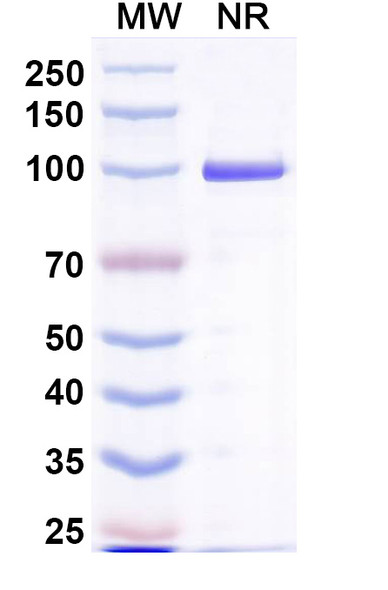 Anti-Escherichia coli ompA Recombinant Nanobody (SAA2320) - SDS-PAGE