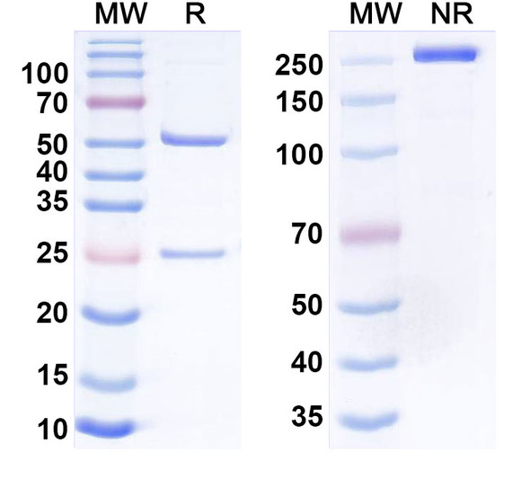 Anti-Histone H1 mimotope (SSVLYGGPPSAA) Recombinant Monoclonal Antibody (SSV mAb) - SDS-PAGE