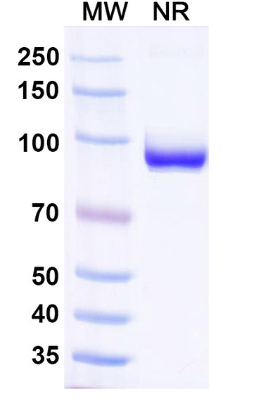 Anti-Human B2M/Beta-2-microglobulin Recombinant Nanobody (SAA2322) - SDS-PAGE