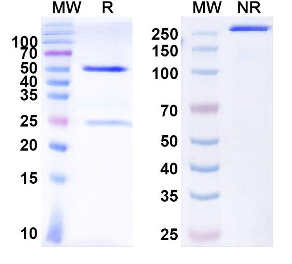Anti-BKPyV Major capsid protein VP1 Recombinant Monoclonal Antibody (336F07) - SDS-PAGE