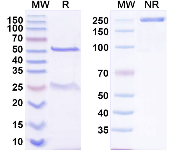 Anti-BKPyV Major capsid protein VP1 Recombinant Monoclonal Antibody (319C07) - SDS-PAGE