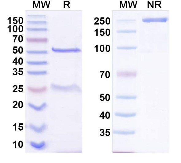 Anti-BKPyV Major capsid protein VP1 Recombinant Monoclonal Antibody (319C07) - SDS-PAGE