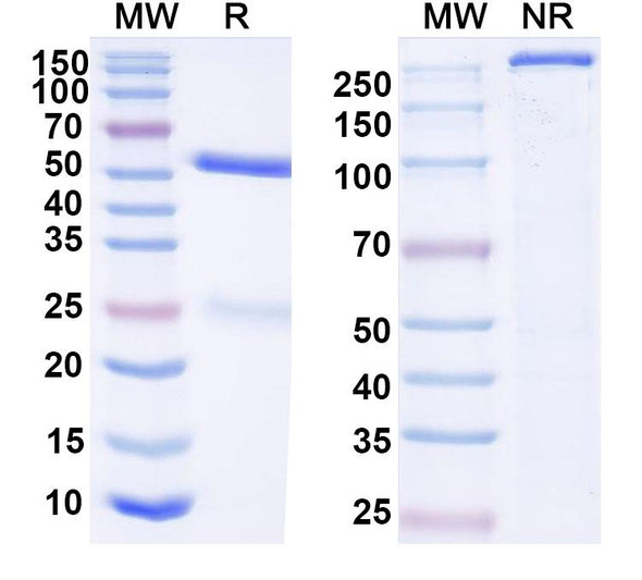 Anti-HIV-1 Envelope glycoprotein gp160 Recombinant Monoclonal Antibody (SAA2326) - SDS-PAGE