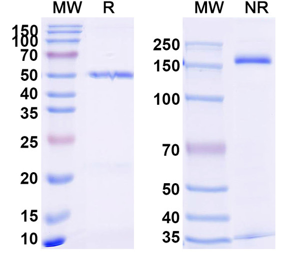 Anti-Human AFP-L3 Recombinant Monoclonal Antibody (SAA2330) - SDS-PAGE