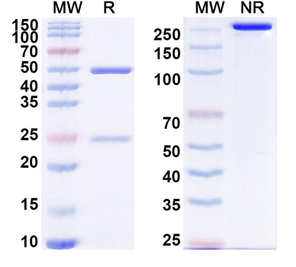 Anti-Human CD357/TNFRSF18/GITR Recombinant Monoclonal Antibody (SAA2341) - SDS-PAGE