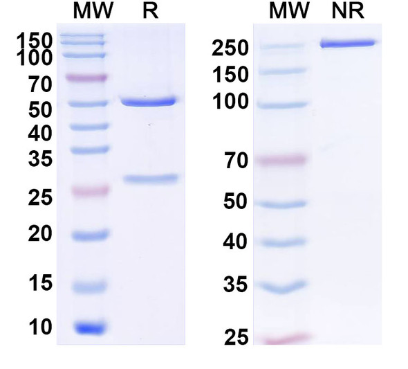 Anti-Human CD357/TNFRSF18/GITR Recombinant Monoclonal Antibody (SAA2342) - SDS-PAGE