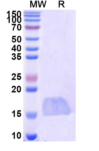 Anti-Naja kaouthia Alpha-cobratoxin Recombinant Nanobody (SAA2343) - SDS-PAGE
