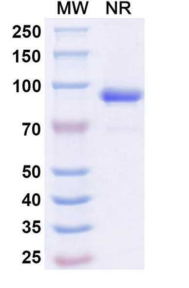 Anti-CHIKV NSP2 Recombinant Monoclonal Antibody (Nb-A9) - SDS-PAGE